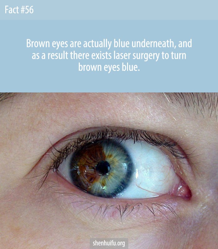 Brown eyes are actually blue underneath, and as a result there exists laser surgery to turn brown eyes blue.
