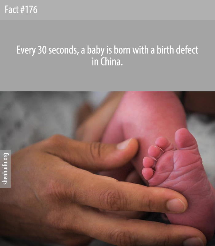 Every 30 seconds, a baby is born with a birth defect in China.