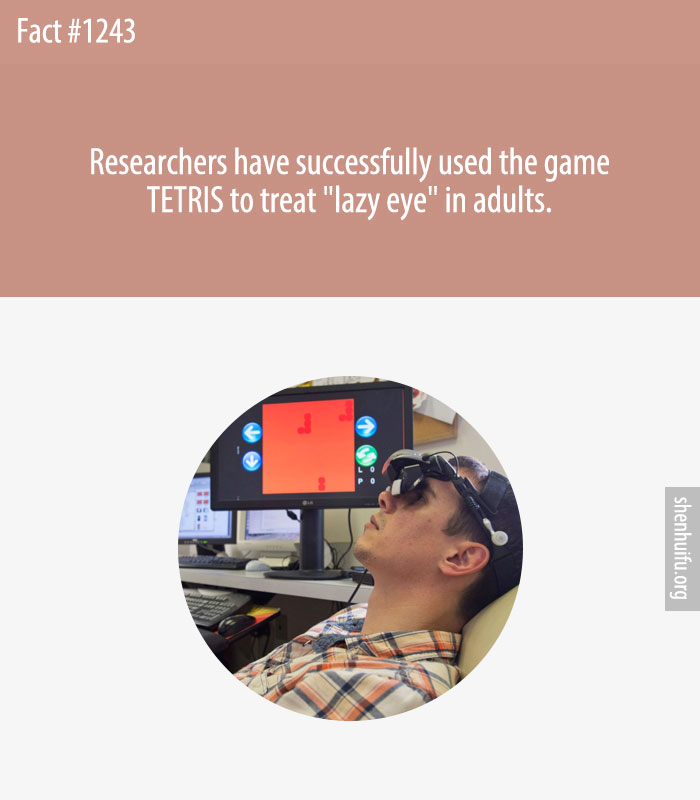 Researchers have successfully used the game TETRIS to treat 'lazy eye' in adults.