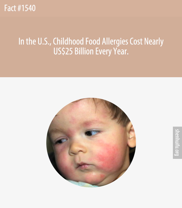 In the U.S., Childhood Food Allergies Cost Nearly US$25 Billion Every Year.