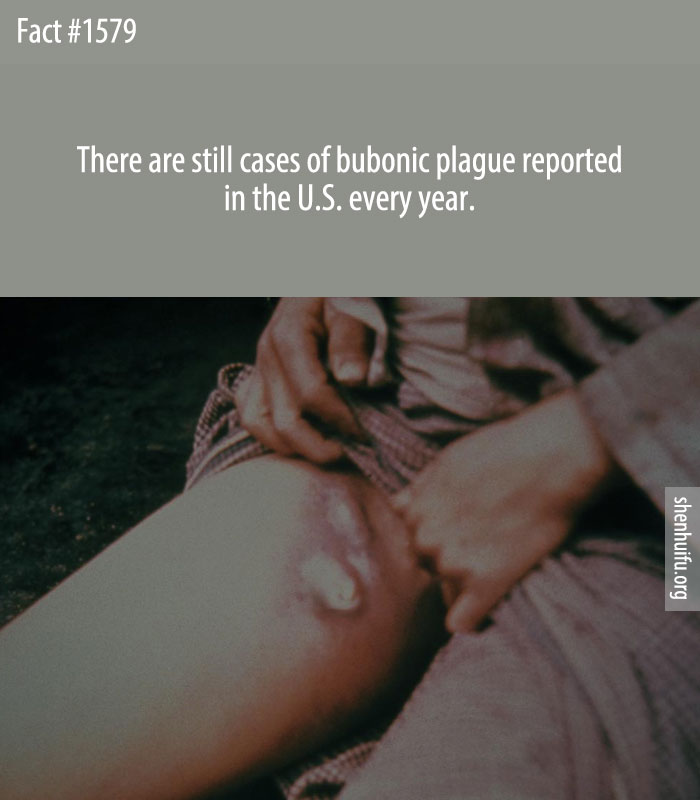 There are still cases of bubonic plague reported in the U.S. every year.